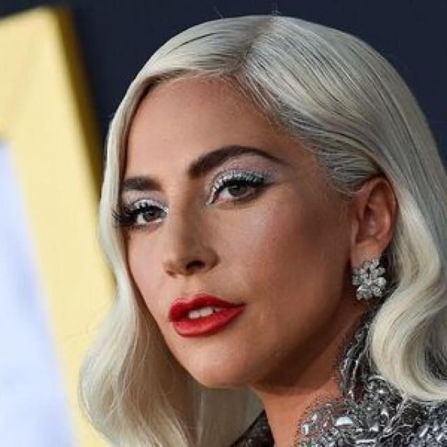 Lady Gaga got her dogs back, kidnapped after shooting