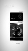 Ariana Grande shows a tomogram of her affected brain