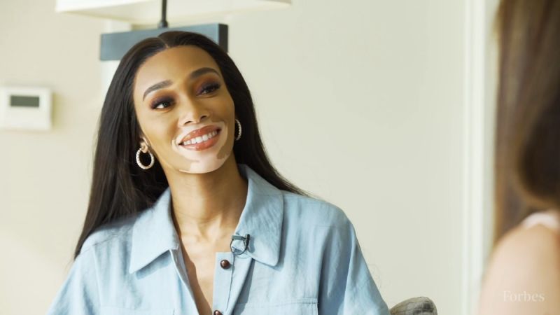 Winnie Harlow surprised with a hairstyle in the Bob Marley style